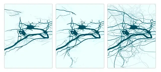 brain-neuronal-network