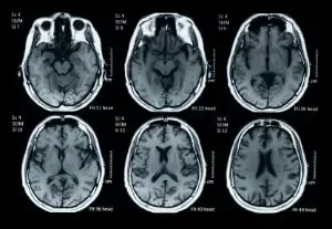 Can You Train Your Mind for Happiness? - Brain scan